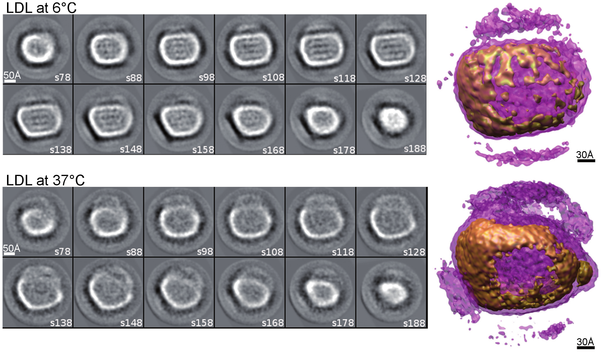 electron micrograph of LDL particles