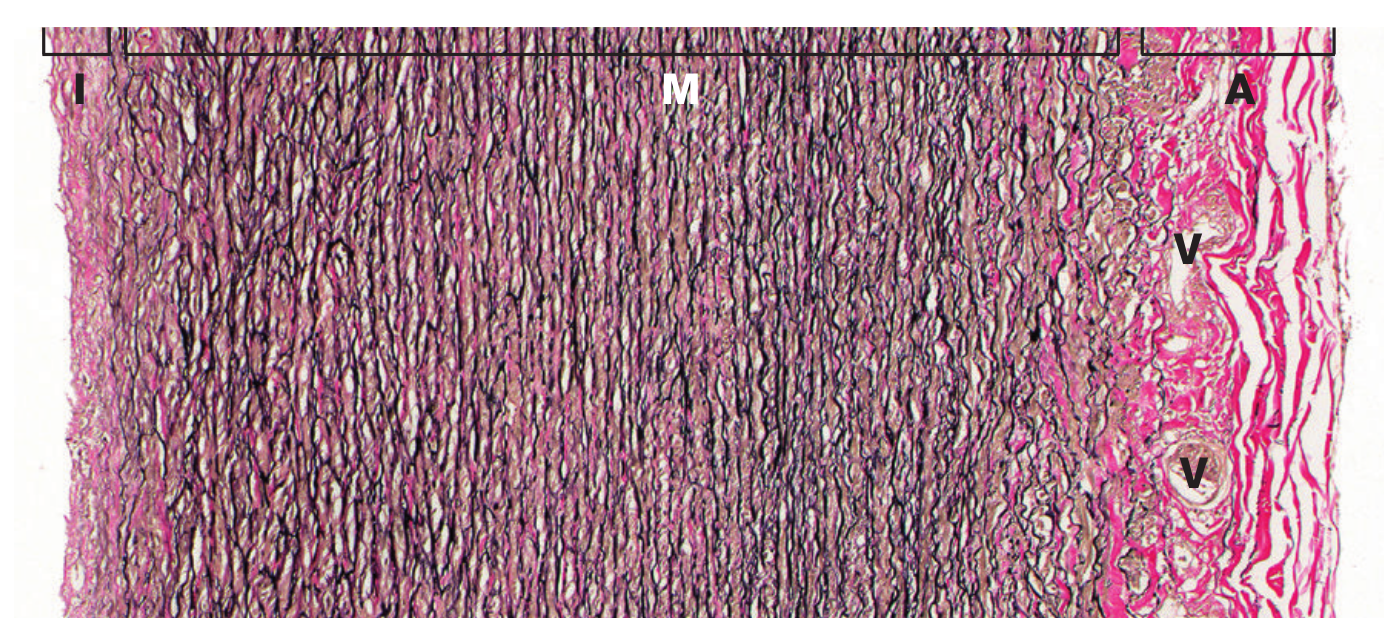 artery histology