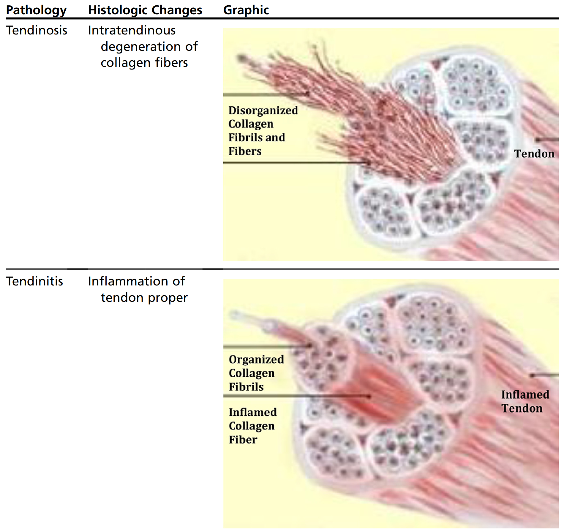 engineering: Tendinopathy, the pathology formerly known as ... Biology Diagrams